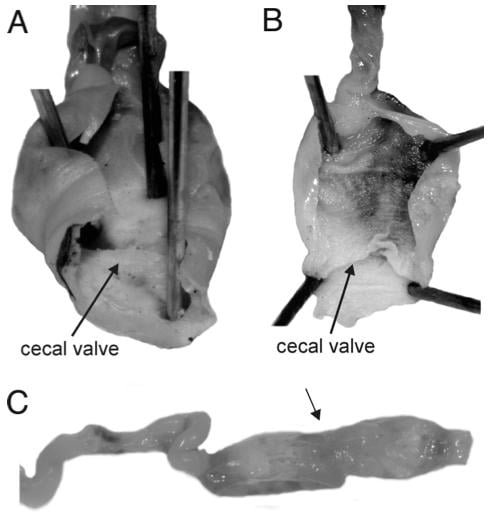 cecal valve
